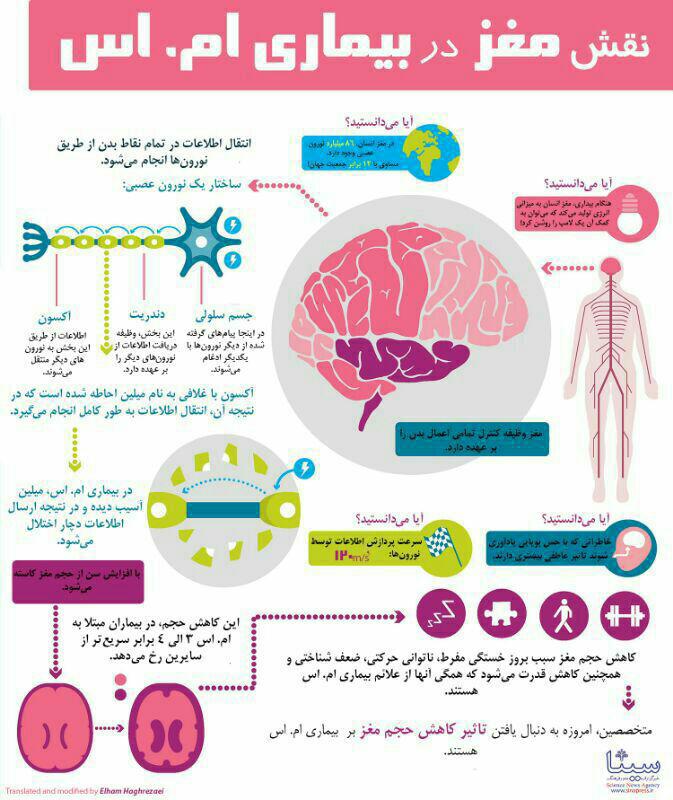 نقش مغز در بیماری ام.اس